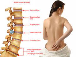 symptoms of spine problems